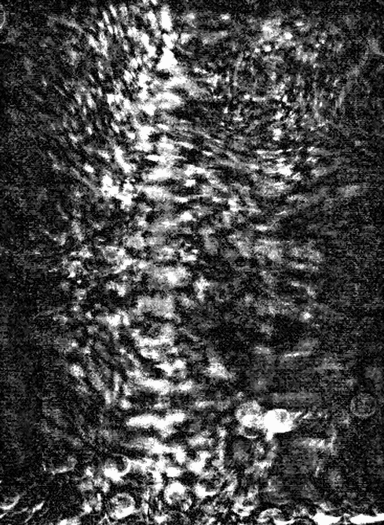 coughing flow visualization 2